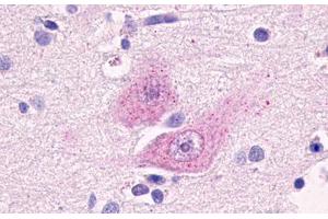Image no. 1 for anti-G Protein-Coupled Receptor 37 Like 1 (GPR37L1) (Cytoplasmic Domain) antibody (ABIN1048810) (GPR37L1 antibody  (Cytoplasmic Domain))