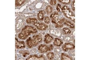 Immunohistochemical staining of human kidney with GRAMD2 polyclonal antibody  shows strong cytoplasmic and membranous positivity in tubular cells.