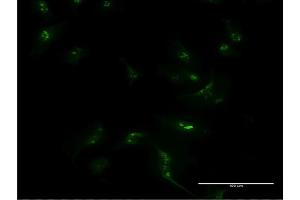 Immunofluorescence of monoclonal antibody to MSX1 on HeLa cell. (MSX1 antibody  (AA 216-297))