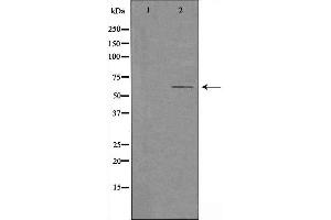 Western blot analysis of extracts from HeLa cells using Cytochrome P450 2U1 antibody.