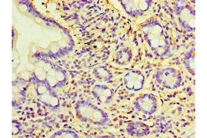 Immunohistochemistry of paraffin-embedded human small intestine tissue using ABIN7157764 at dilution of 1:100 (CCBL2 antibody  (AA 1-454))