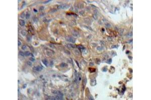 #VALUE! (PKC theta antibody  (AA 380-634))