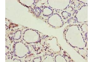 Immunohistochemistry of paraffin-embedded human thyroid tissue using ABIN7170271 at dilution of 1:100 (GPR172B antibody  (AA 212-279))