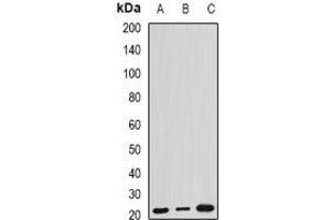 Western blot analysis of ARL6 expression in HEK293T (A), mouse kidney (B), mouse brain (C) whole cell lysates.