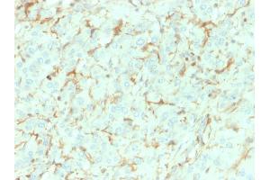 Formalin-fixed, paraffin-embedded human Adrenal Gland stained with NGFR Mouse Monoclonal Antibody (NGFR/1964). (NGFR antibody  (AA 281-421))
