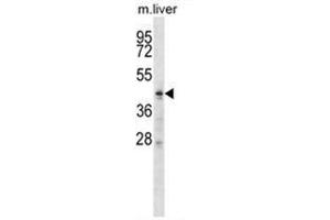 ZDHHC6 Antibody (C-term) western blot analysis in mouse liver tissue lysates (35 µg/lane). (ZDHHC6 antibody  (C-Term))