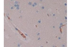 Detection of NXN in Human Cerebrum Tissue using Polyclonal Antibody to Nucleoredoxin (NXN) (NXN antibody  (AA 166-327))