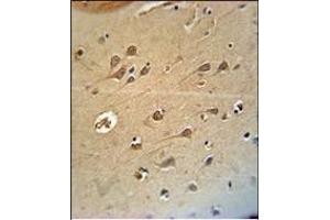 RAT DLG4 Antibody (C-term)(Ascites) ABIN658997 immunohistochemistry analysis in formalin fixed and paraffin embedded human brain tissue followed by peroxidase conjμgation of the secondary antibody and DAB staining. (DLG4 antibody  (C-Term))