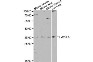 Western blot analysis of extracts of various cell lines, using HAVCR2 antibody. (TIM3 antibody)