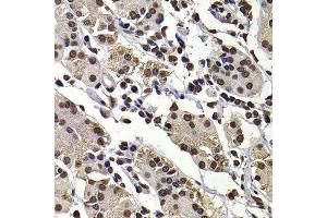 Immunohistochemistry of paraffin-embedded human stomach using DNAJB6 antibody. (DNAJB6 antibody  (AA 177-326))