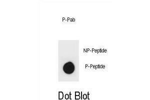 Dot blot analysis of IKKB Antibody (Phospho ) Phospho-specific Pab (ABIN1881453 and ABIN2839976) on nitrocellulose membrane.