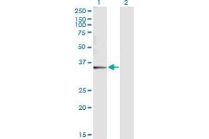 Western Blot analysis of SNX11 expression in transfected 293T cell line by SNX11 monoclonal antibody (M05), clone 2G1. (SNX11 antibody  (AA 1-270))