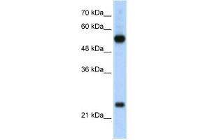WB Suggested Anti-RPL13 Antibody Titration:  2. (RPL13 antibody  (C-Term))