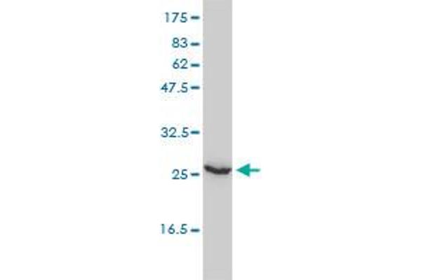 Ube2t antibody  (AA 1-197)