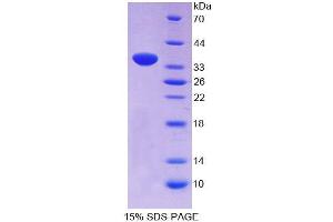 SDS-PAGE (SDS) image for Pericentrin (PCNT) (AA 2987-3246) protein (His tag) (ABIN6238638) (PCNT Protein (AA 2987-3246) (His tag))