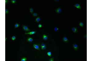 Immunofluorescent analysis of A2780 cells using ABIN7173225 at dilution of 1:100 and Alexa Fluor 488-congugated AffiniPure Goat Anti-Rabbit IgG(H+L)