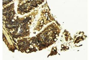ABIN6277056 at 1/100 staining Mouse colon tissue by IHC-P. (CTNNB1 antibody  (C-Term))