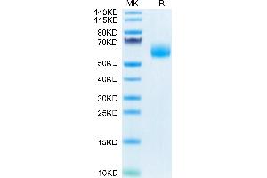 Human IL-1 Rrp2 (C154S,C262S) on Tris-Bis PAGE under reduced condition. (IL1RL2 Protein (Cys154Ser-Mutant, Cys262Ser-Mutant) (His tag))