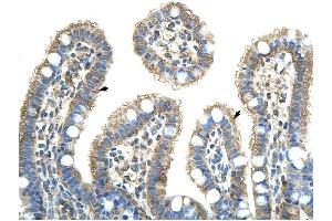 NXF5 antibody was used for immunohistochemistry at a concentration of 4-8 ug/ml to stain Epithelial cells of intestinal villus (arrows) in Human Intestine.