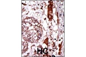 Immunohistochemistry (Paraffin-embedded Sections) (IHC (p)) image for anti-Guanine Nucleotide Binding Protein (G Protein), beta Polypeptide 2-Like 1 (GNB2L1) (AA 29-58), (N-Term) antibody (ABIN392636)