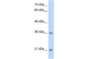 WB Suggested Anti-TCF15 Antibody Titration:  2. (TCF15 antibody  (N-Term))