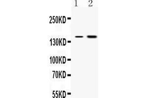 Western blot analysis of Insulin Receptor expression in rat kidney extract ( Lane 1) and HEPG2 whole cell lysates ( Lane 2).