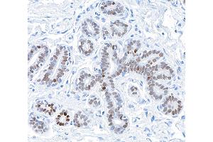 Immunohistochemistry (IHC) image for anti-GATA Binding Protein 3 (GATA3) (AA 150-200) antibody (ABIN7455153) (Recombinant GATA3 antibody  (AA 150-200))