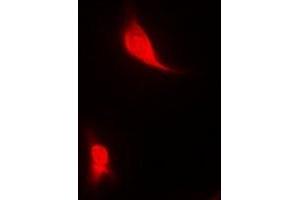 Immunofluorescent analysis of EGLN1 staining in MCF7 cells. (EGLN1 antibody)