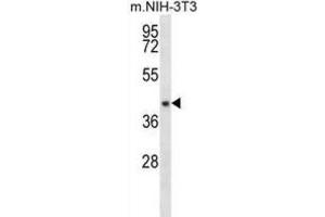Western Blotting (WB) image for anti-Nudix (Nucleoside Diphosphate Linked Moiety X)-Type Motif 9 (NUDT9) antibody (ABIN2996610) (NUDT9 antibody)