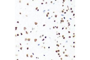Immunohistochemistry of paraffin-embedded mouse brain using H1F0 antibody (ABIN5971687) at dilution of 1/100 (40x lens). (Histone H1 antibody)