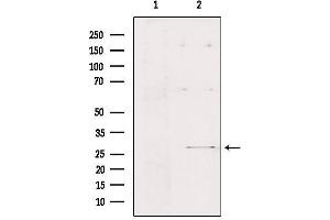 Western blot analysis of extracts from Hepg2, using FMR1NB Antibody. (FMR1NB antibody  (C-Term))