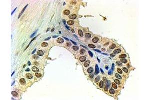 IHC staining of FFPE human prostate with Androgen receptor antibody at 2ug/ml. (Androgen Receptor antibody)
