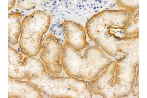 ABIN6265338 and ABIN6276619 at 1/100 staining human normal kidney tissue by IHC-P.