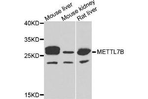 Western blot analysis of extracts of various cells, using METTL7B antibody. (METTL7B antibody)