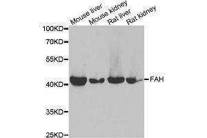 Western blot analysis of extracts of various cell lines, using FAH antibody. (FAH antibody)