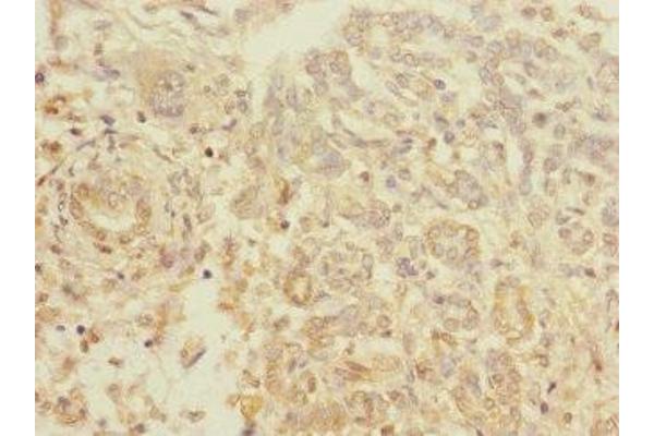 TIGD7 antibody  (AA 1-300)