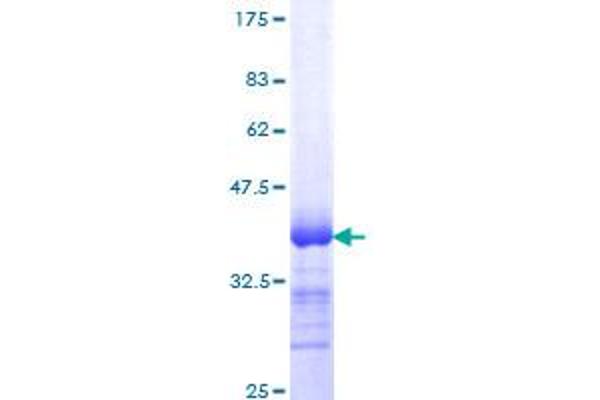 Integrin beta 5 Protein (ITGB5) (AA 421-516) (GST tag)