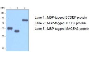 Western Blotting (WB) image for anti-MBP Tag antibody (ABIN317540) (MBP Tag antibody)
