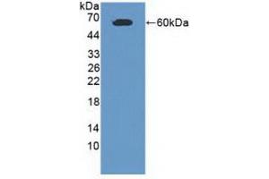 Detection of Recombinant CADM1, Human using Polyclonal Antibody to Cell Adhesion Molecule 1 (CADM1) (CADM1 antibody  (AA 27-292))