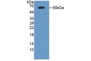 Detection of Recombinant CADM1, Human using Polyclonal Antibody to Cell Adhesion Molecule 1 (CADM1) (CADM1 antibody  (AA 27-292))