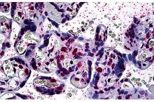 Human Placenta: Formalin-Fixed, Paraffin-Embedded (FFPE) (ARID3A antibody  (AA 317-417))