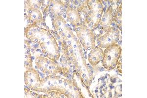 Immunohistochemistry of paraffin-embedded rat kidney using BMPR1B antibody (ABIN5971046) at dilution of 1/200 (40x lens). (BMPR1B antibody)