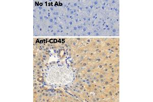 Immunohistochemistry (IHC) image for anti-Protein tyrosine Phosphatase, Receptor Type, C (PTPRC) (C-Term) antibody (ABIN6254210) (CD45 antibody  (C-Term))