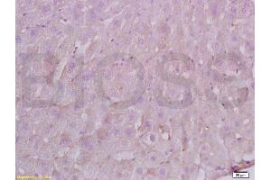 Formalin-fixed and paraffin embedded Rat liver labeled with Anti-FBN1/fibrillin 1 Polyclonal Antibody, Unconjugated (ABIN738501) at 1:200 followed by conjugation to the secondary antibody and DAB staining.