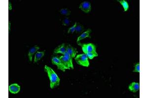 Immunofluorescent analysis of MCF-7 cells using ABIN7169736 at dilution of 1:100 and Alexa Fluor 488-congugated AffiniPure Goat Anti-Rabbit IgG(H+L) (C12orf69 antibody  (AA 1-154))