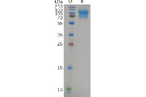CD164 (CD164) (AA 24-162) protein (Fc Tag)