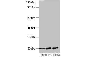 Western blot All lanes: TPRKB antibody at 5 μg/mL Lane 1: A549 whole cell lysate Lane 2: Jurkat whole cell lysate Lane 3: MCF-7 whole cell lysate Secondary Goat polyclonal to rabbit IgG at 1/10000 dilution Predicted band size: 20, 17, 24 kDa Observed band size: 20 kDa (TPRKB antibody  (AA 1-175))