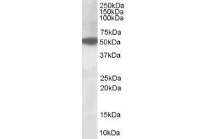 ABIN185314 (1µg/ml) staining of HepG2lysate (35µg protein in RIPA buffer). (AKT3 antibody  (AA 119-133))