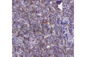 ABIN6268692 at 1/100 staining human Lymph node tissues sections by IHC-P. (IL-8 antibody  (Internal Region))