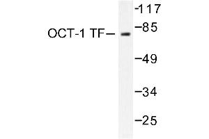 Image no. 2 for anti-POU Domain, Class 2, Transcription Factor 1 (POU2F1) antibody (ABIN271753) (POU2F1 antibody)